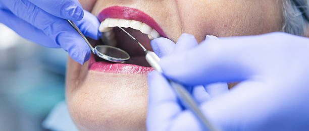 Best Emergency Dental Care for Abscessed Tooth in Roodhouse, IL
